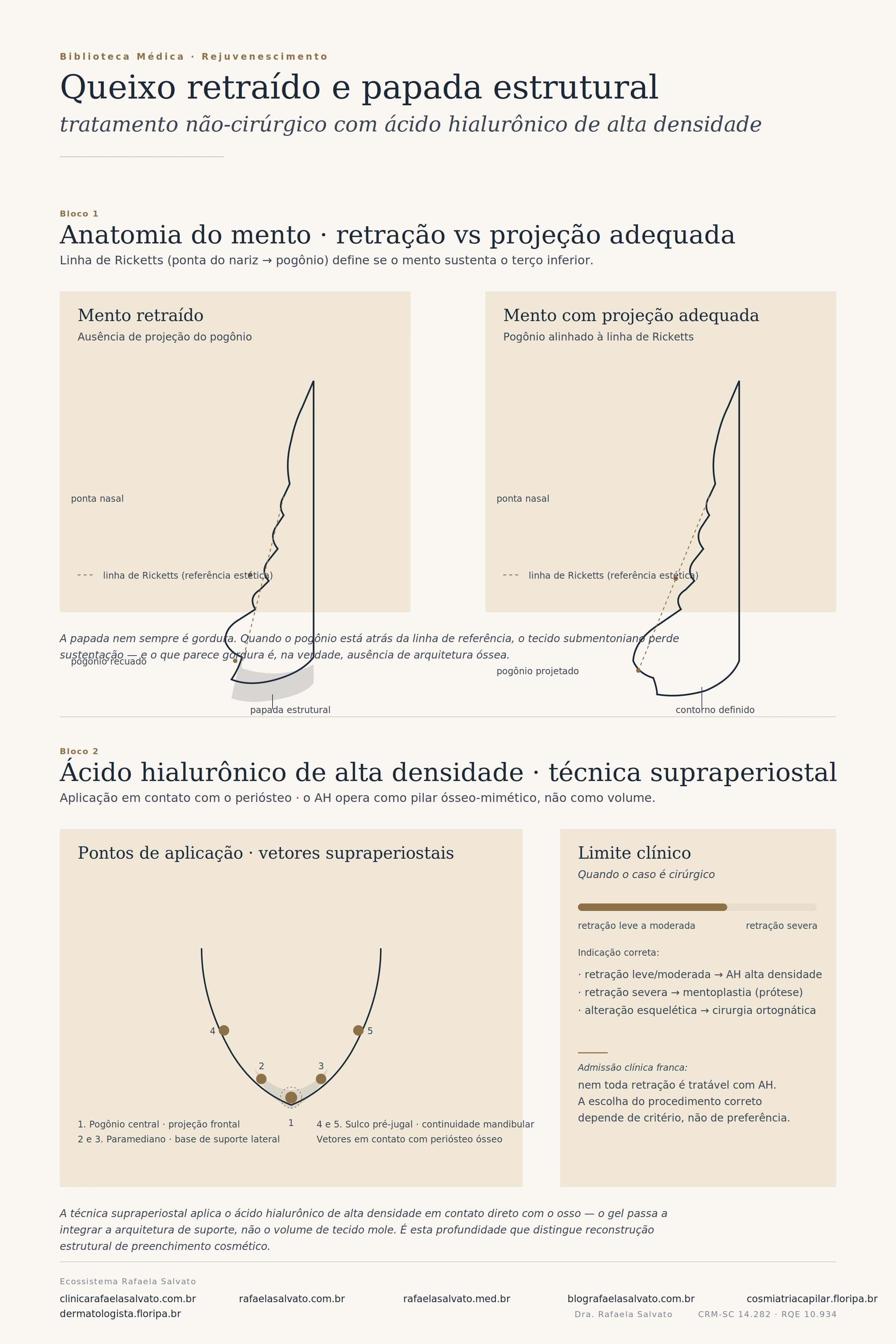 Infográfico sobre tratamento não-cirúrgico de queixo retraído e papada estrutural
