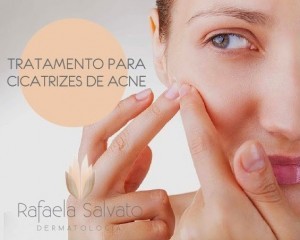 tratamento acne florianopolis dermatologista