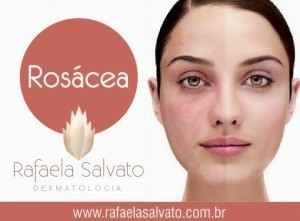 rosacea