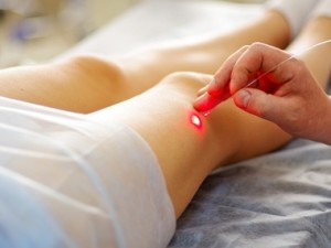 tratamento de varizes dermatologista florianopolis