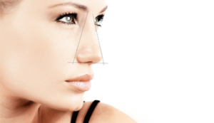 rinomodelação florianópolis