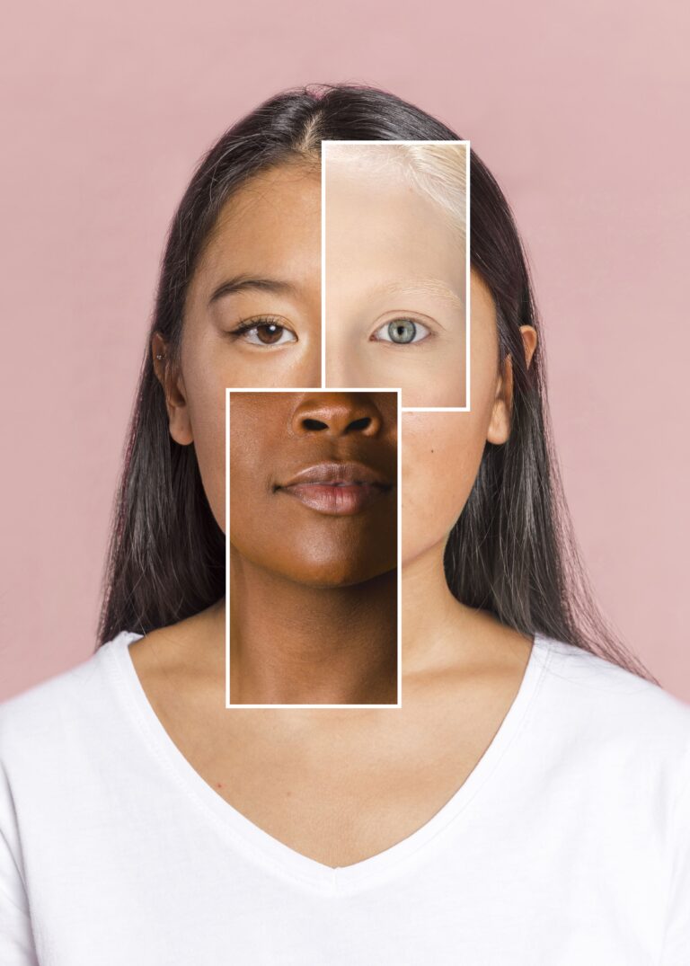 paciente da médica dermatologista rafaela salvato CRM/SC 14.282 5 tipos de pele