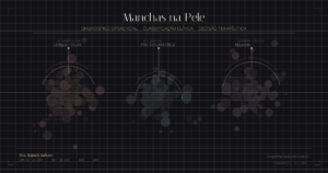 Infográfico médico com fundo escuro mostrando três zonas de pigmentação cutânea — lentigo solar, hiperpigmentação pós-inflamatória e melasma — representadas por clusters de tonalidades distintas com arcos dermatoscópicos, notação clínica e grid cartográfico, identificando visualmente o diagnóstico diferencial de manchas na pele. Autoria: Dra. Rafaela Salvato, dermatologista em Florianópolis, CRM-SC 14.282